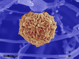 Imagen: Una espora sexual (zigospora) del zigomiceto patógeno humano, Mucor circinelloides. (Fotografía cortesía de Valerie Knowlton, Universidad Estatal de Carolina del Norte).